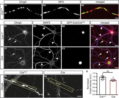 Deletion of β-Neurexins in Mice Alters the Distribution of Dense-Core Vesicles in Presynapses of Hippocampal and Cerebellar Neurons